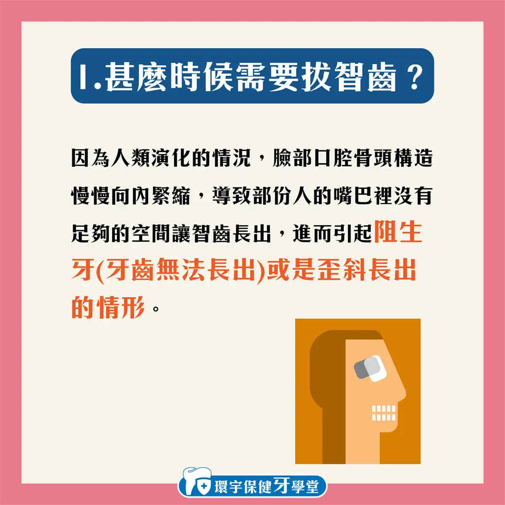 智齒要拔嗎?為甚麼會有智齒呢? 智齒要拔嗎?為甚麼會有智齒呢?