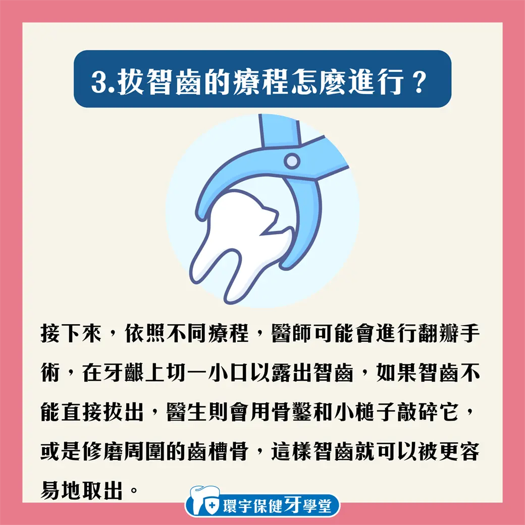 智齒要拔嗎?為甚麼會有智齒呢? 智齒要拔嗎?為甚麼會有智齒呢?