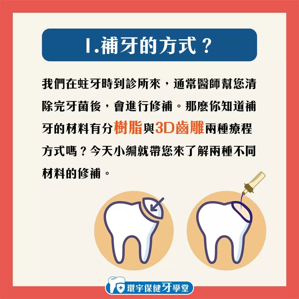 環宇保健牙學堂 - 3D齒雕與樹脂補牙差在哪裡? 環宇保健牙學堂 - 3D齒雕與樹脂補牙差在哪裡?